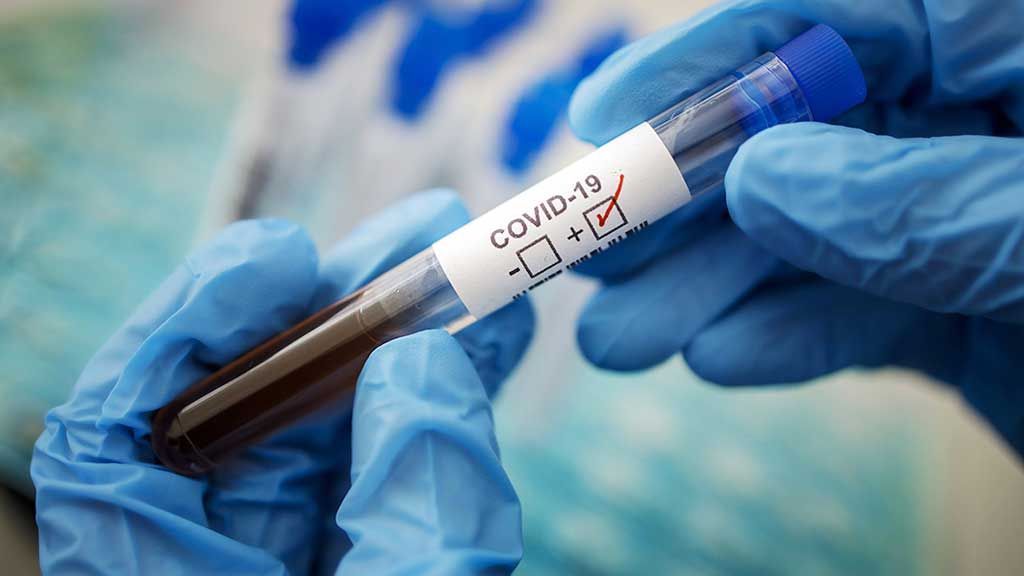 В Україні за добу - 182 нових випадків коронавірусної хвороби COVID-19