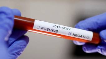 Новосанжарцю зробили тест на коронавірус
