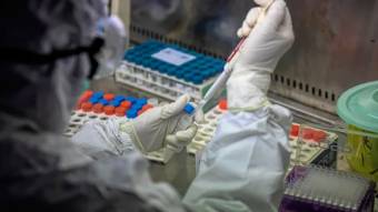 Новосанжарка, хвора на коронавірус, лікується в Полтаві