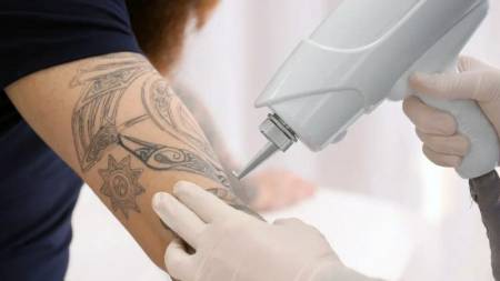 Про татуювання, їх значення і неодимовий лазер від Alvi Prague