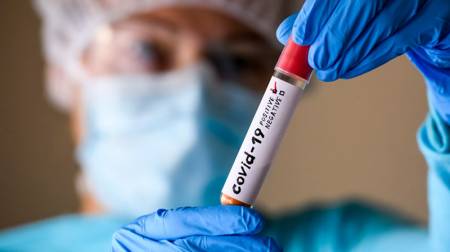 Ковід забрав життя мешканця Кременчуцької громади