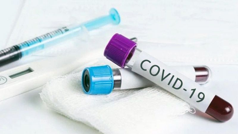 Поки що всі тести на коронавірус зроблені у Кобеляках – негативні