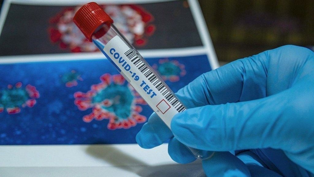 В Україні зафіксовано 876 нових випадків коронавірусної хвороби COVID-19 