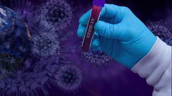 В Україні зафіксовано 810 нових випадків коронавірусної хвороби COVID-19