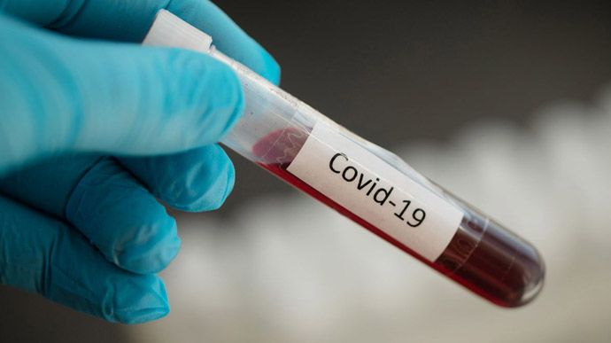 В Україні зафіксовано 612 нових випадків коронавірусної хвороби COVID-19