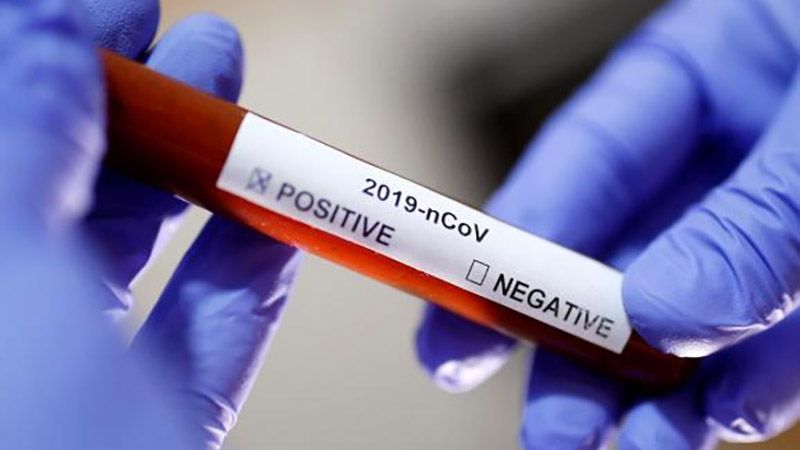 В Україні зафіксовано 651 новий випадок коронавірусної хвороби COVID-19