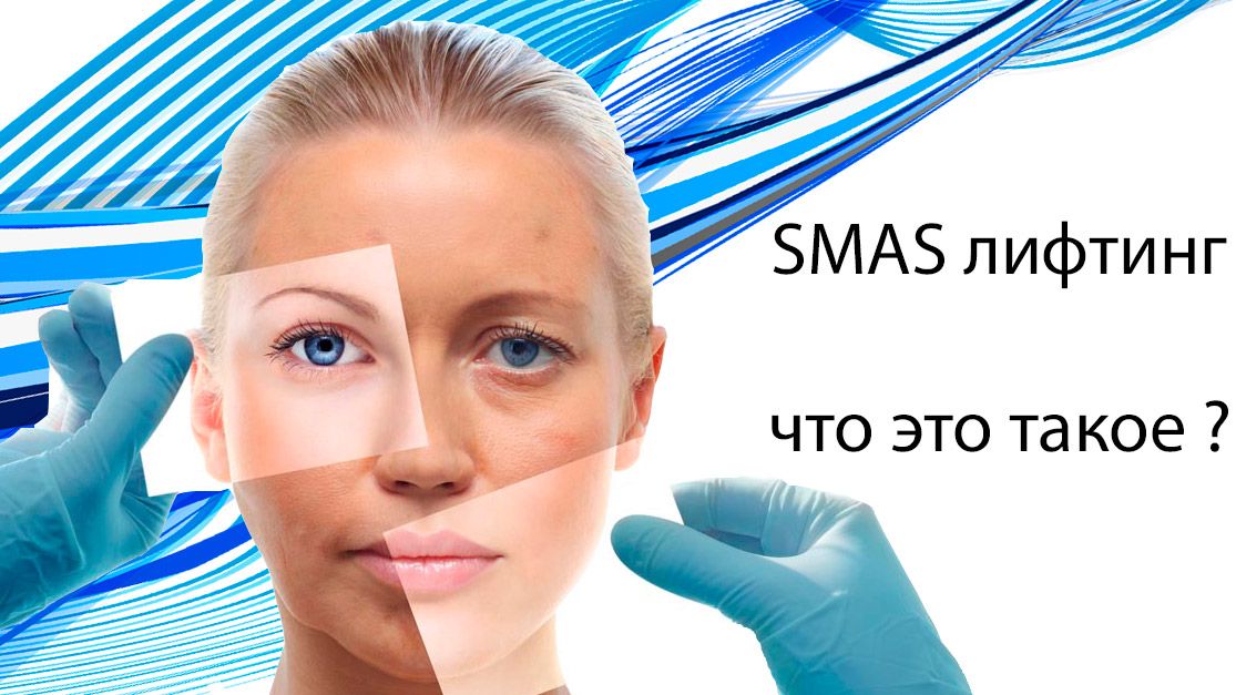 SMAS-лифтинг. Перспективное направление в косметологии