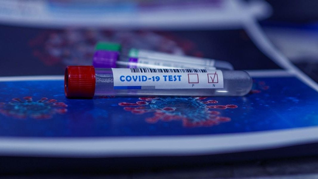 В Україні кількість випадків коронавірусної хвороби COVID-19 наблизилась до 62 тисяч