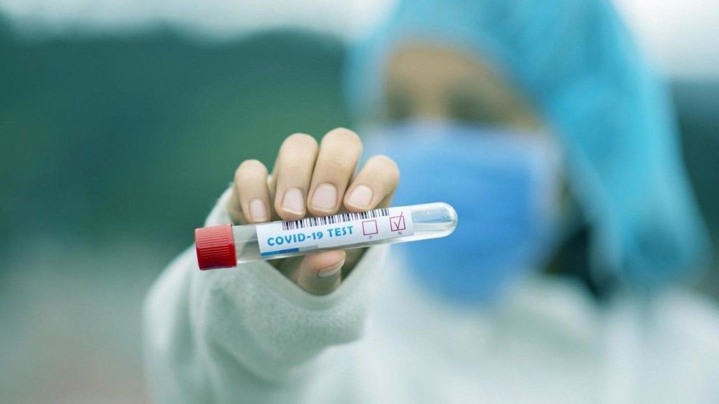 В Україні зафіксовано 1318 нових випадків коронавірусної хвороби COVID-19 — це антирекорд з кількості захворівших на добу