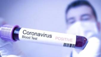 У Руденківці учні й педагоги захворіли на коронавірус