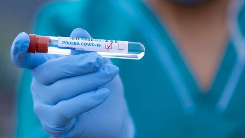 У працівника кобеляцького відділення ПриватБанку виявили коронавірус