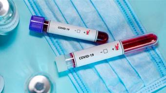 В Україні зафіксовано 5 469 нових випадків коронавірусної хвороби COVID-19