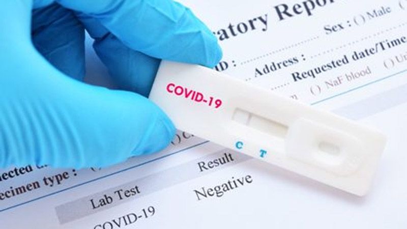 Уряд врегулював процедуру розслідування випадків смерті медпрацівників від COVID-19