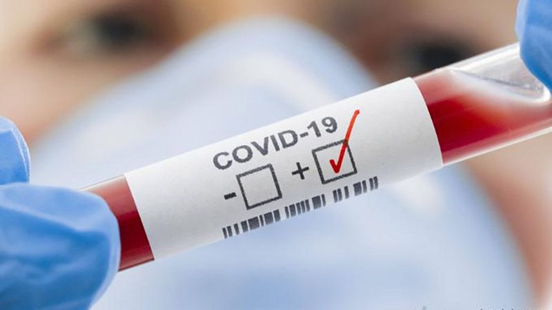 На Полтавщині за минулу добу зареєстровано 126 нових випадків захворювання на COVID-19