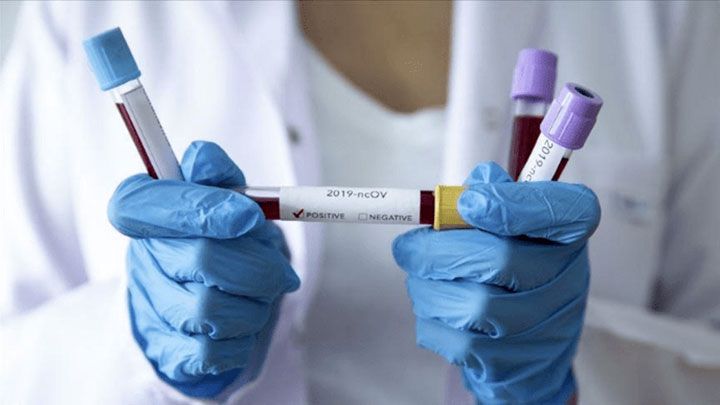 В Україні за добу - 6 796 нових випадків коронавірусної хвороби COVID-19
