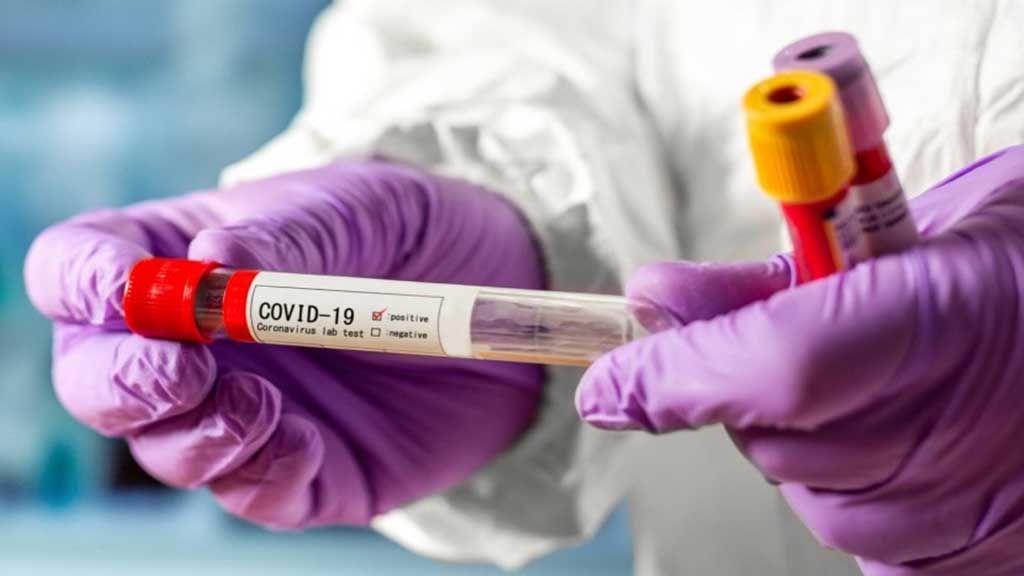 В Україні за добу - 11 996 нових випадків коронавірусної хвороби COVID-19