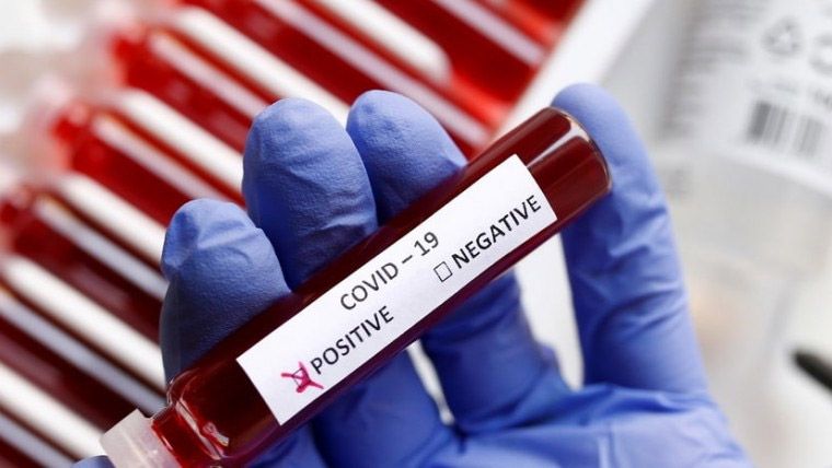 За тиждень на Полтавщині виявили 347 нових випадків захворювання на COVID-19