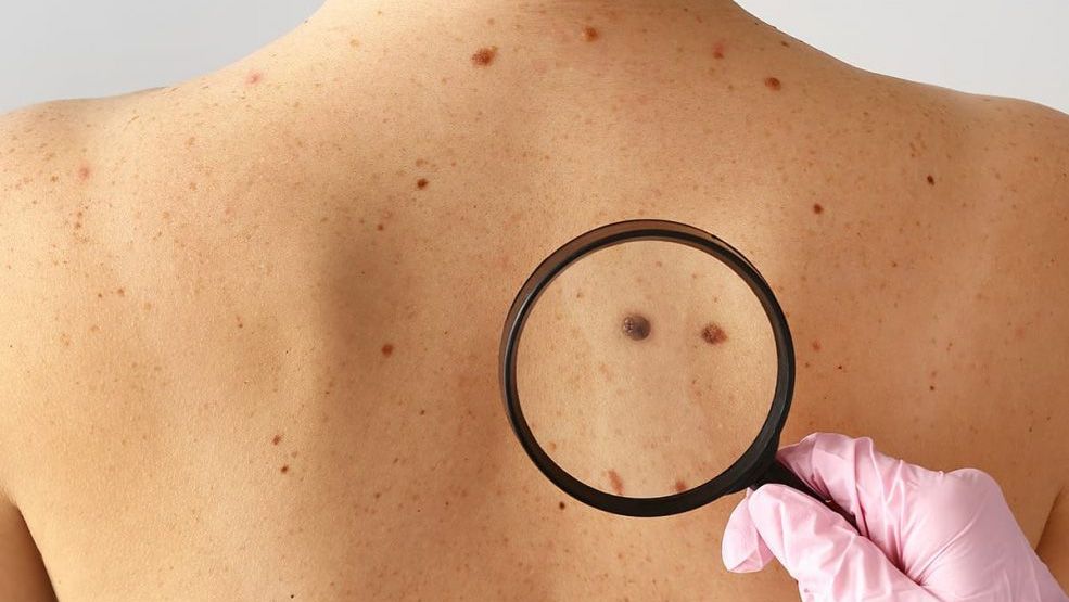 Чому важливо підвищувати кваліфікацію у сфері діагностики шкірних пухлин