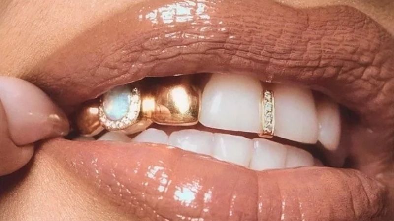 Найбільш незвичайні стоматологічні процедури у світі