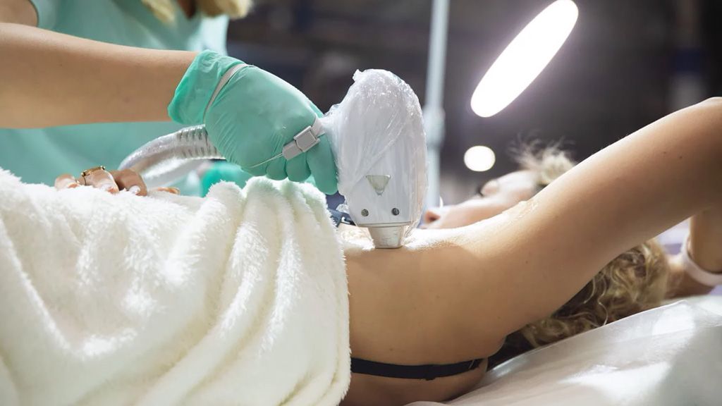 Діодний лазер і лазерний апарат для видалення волосся: повний розбір можливостей професійного обладнання