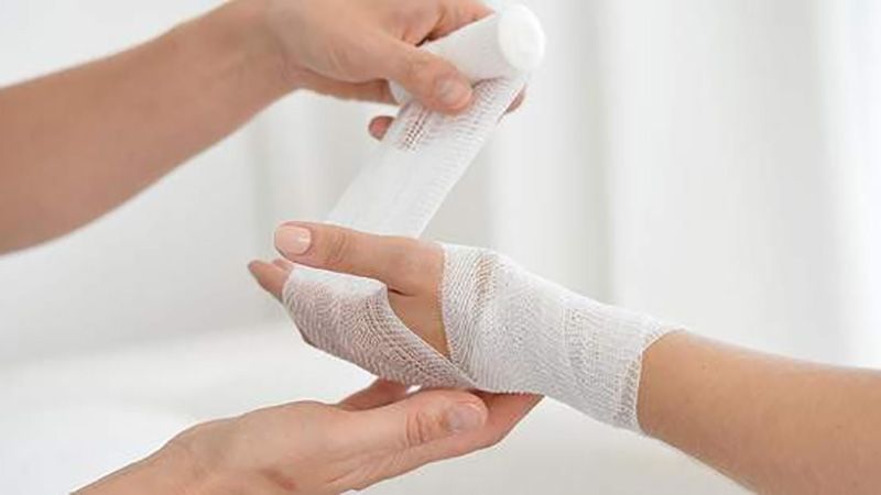 На Лубенщині внаслідок вибуху жінка втратила пальці