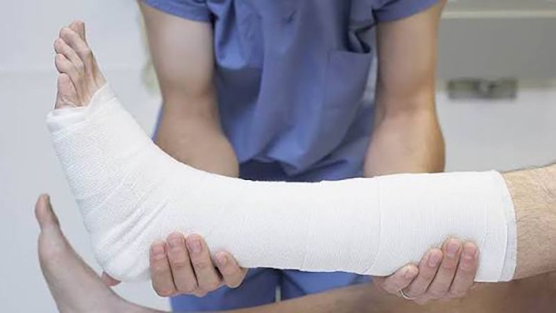Небезпечні розваги в котловані: у Горішніх Плавнях 14-річний підліток зламав ногу